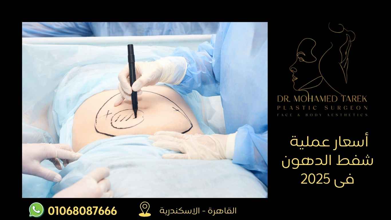 اسعار-عملية-شفط-الدهون-في-2025